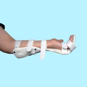 Dorsal Splint