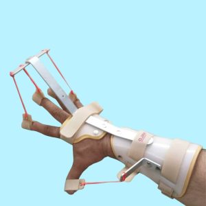 Dynamic Hand Splint