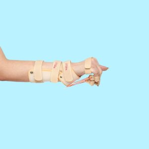 Knuckle Bender Splint